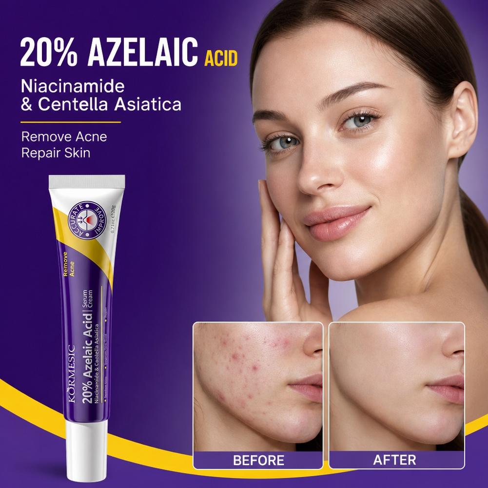 Эссенция с 20% азелаиновой кис – обзор и цена Luxury Skincare Brands